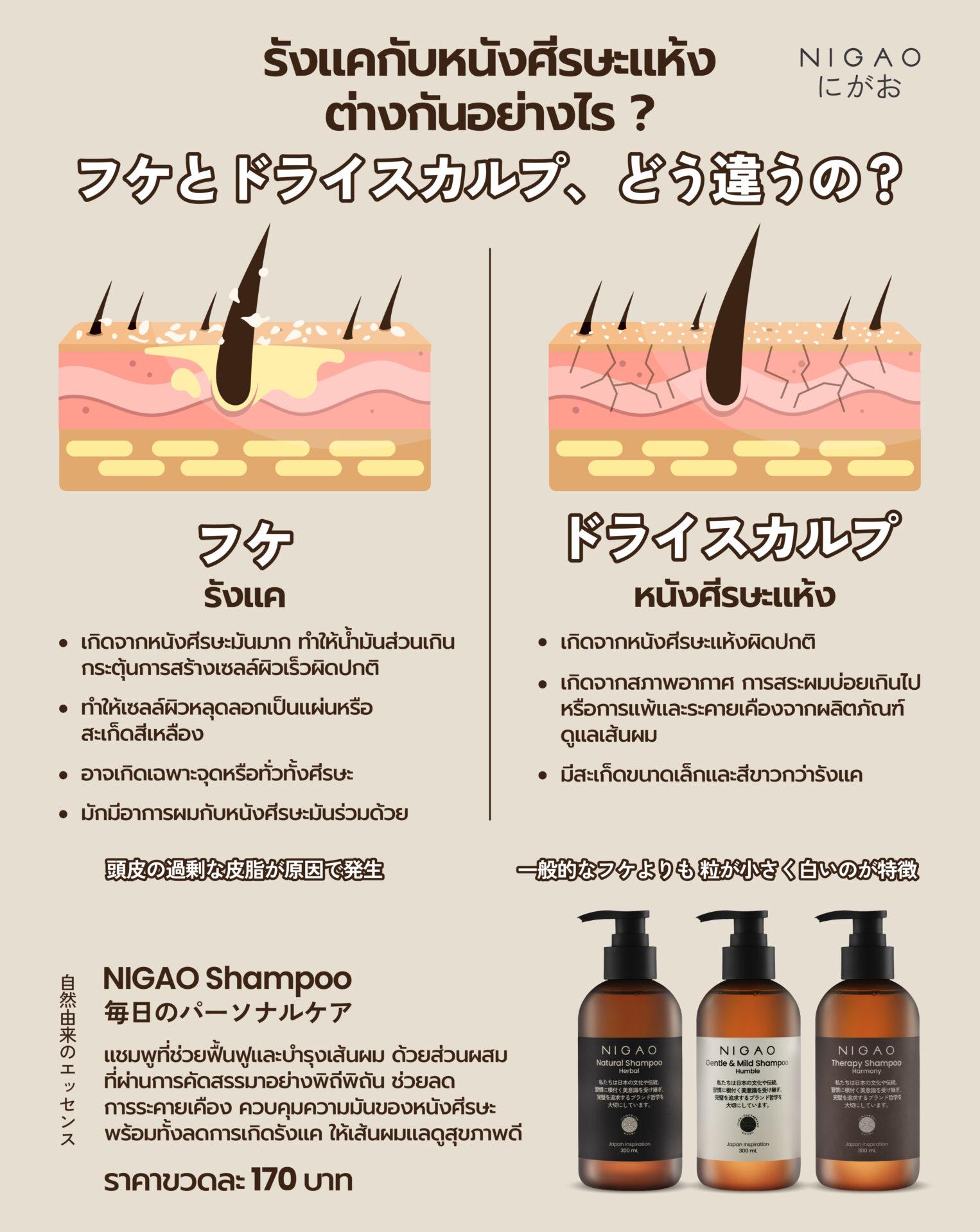 อินโฟกราฟิกเปรียบเทียบรังแคกับหนังศีรษะแห้ง แสดงความแตกต่างของสะเก็ดสีเหลืองและสะเก็ดสีขาว