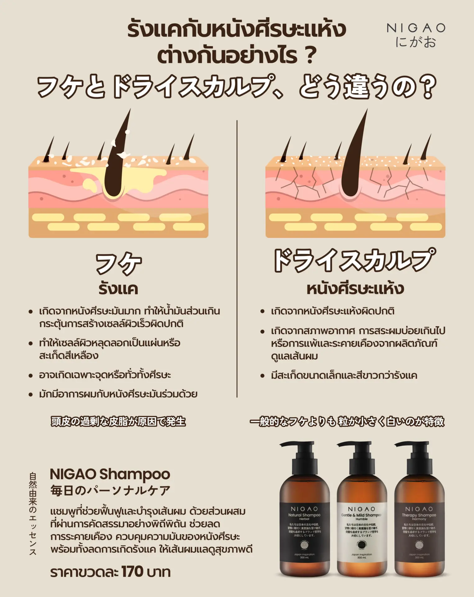 อินโฟกราฟิกเปรียบเทียบรังแคกับหนังศีรษะแห้ง แสดงความแตกต่างของสะเก็ดสีเหลืองและสะเก็ดสีขาว